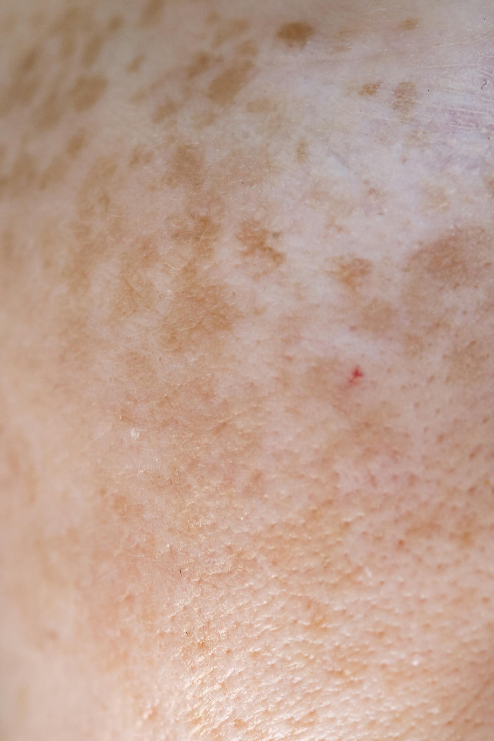 Extreme close-up of freckled Caucasian skin displaying texture and natural pigmentation.